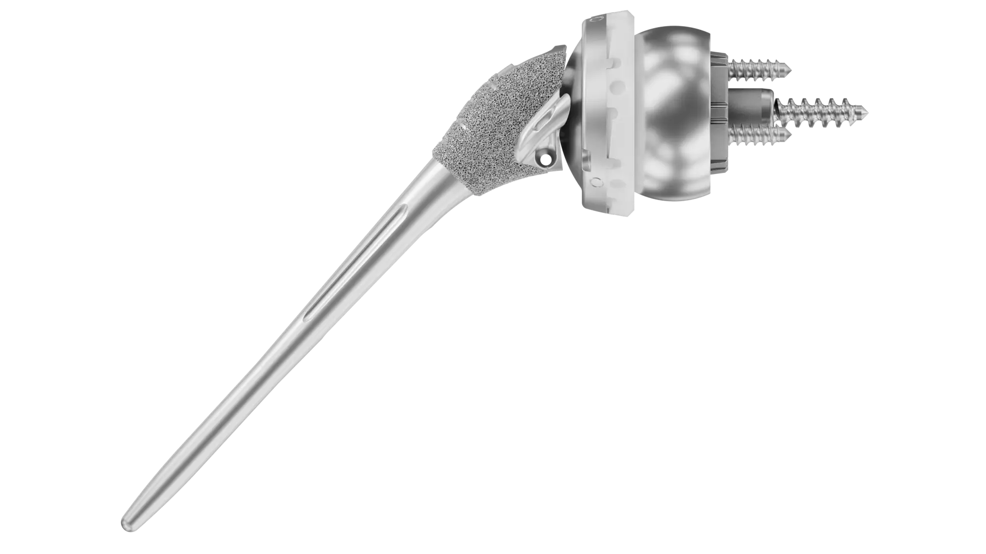 Reverse shoulder replacement used to treat a proximal humerus fracture