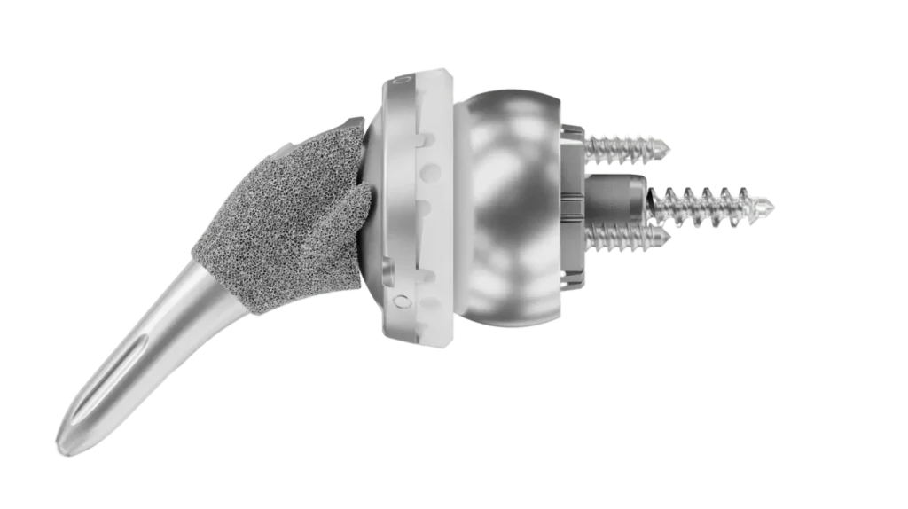 Reverse shoulder replacement implant from Shoulder Innovations