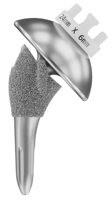 Total shoulder replacement implant from Shoulder Innovations